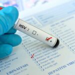 Herpes genital: o que é, sintomas e como tratar