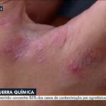 Fazendeiro é condenado por pulverização aérea com agrotóxico em propriedade na zona rural de Governador Eugênio Barros