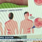 Como vírus antigos podem ajudar a combater a resistência de bactérias a antibióticos | Saúde