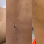 Criança de 4 anos é espancada por pai e madrasta em Olinda